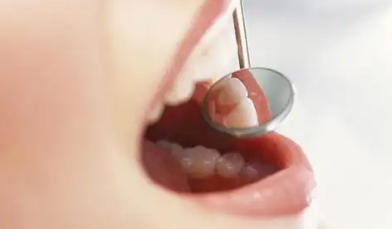 牙齿敏感能补牙吗