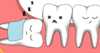 两侧智齿间隔多久时间拔