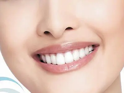 牙齿美白是做冷光美白好还是牙贴面好