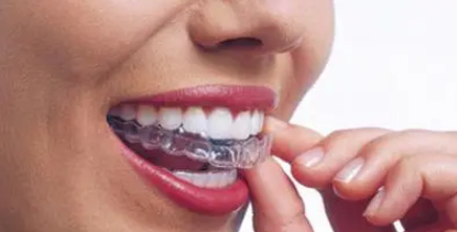 正畸需要拔牙吗