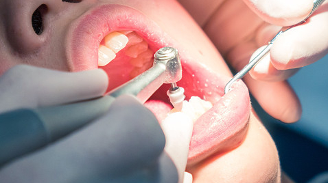 牙龈肿痛的科学应对
